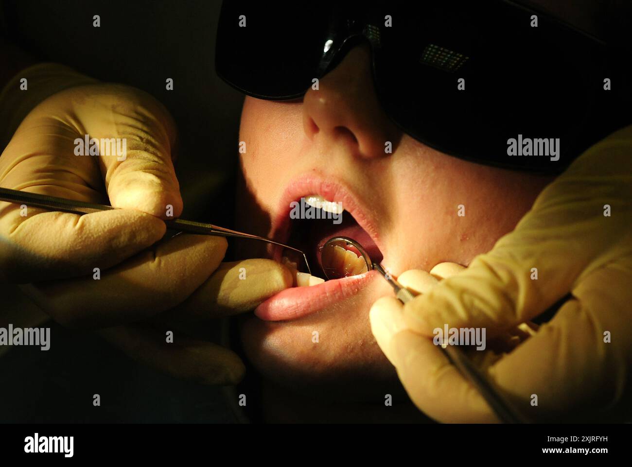 Foto del file del 19/05/11 di un dentista al lavoro. I dentisti hanno messo in guardia i ministri scozzesi dall'autocompiacimento nonostante i progressi "graditi” in materia di riforma dei pagamenti. Uno schema introdotto a novembre prevede che i dentisti che forniscono cure NHS ricevano maggiori commissioni. I check-up rimangono gratuiti per tutti i pazienti, con donne incinte e neomamme, coloro che chiedono prestazioni e i minori di 26 anni ancora esenti da spese. Data di emissione: Sabato 20 luglio 2024. Foto Stock