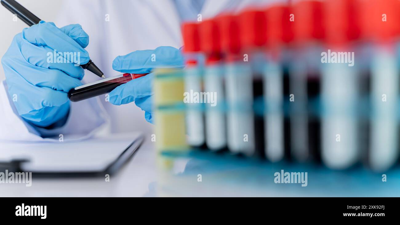 Mano del medico che tiene una fiala per il campione di sangue, prova il dispositivo medico, tenendo una fiala di campione di sangue davanti al modello di test. Donna che lavora con una sacca di sangue Foto Stock