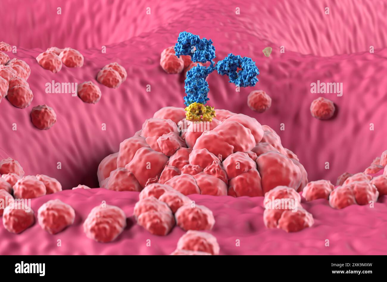 Trattamento con anticorpi monoclonali nel cancro dello stomaco (gastrico) - Vista ravvicinata illustrazione 3d. Foto Stock