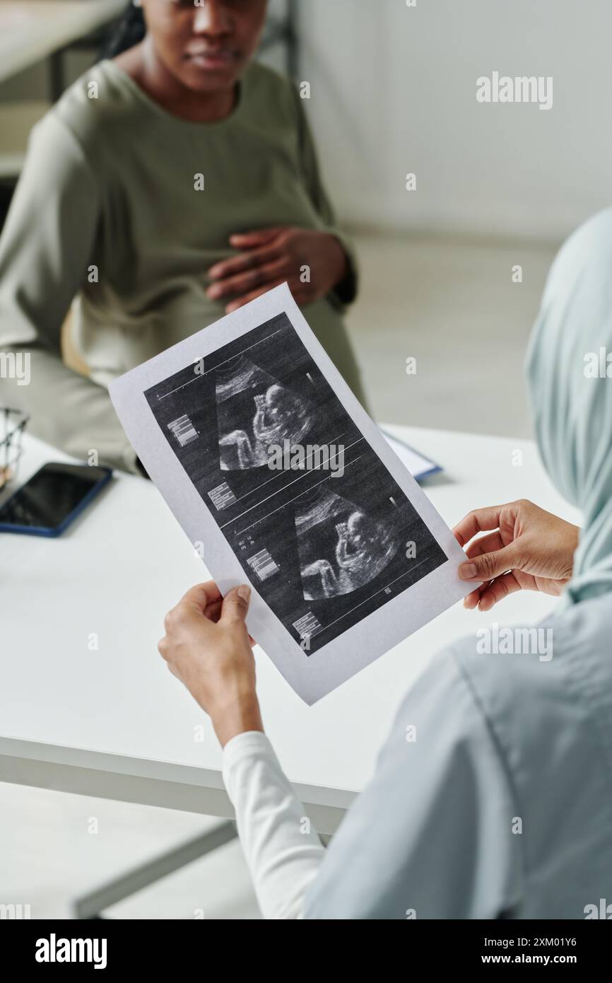 Ecografia del feto su carta in mani di medico femminile seduto sul posto di lavoro in ufficio medico e discutere i risultati dell'ecografia con il paziente Foto Stock