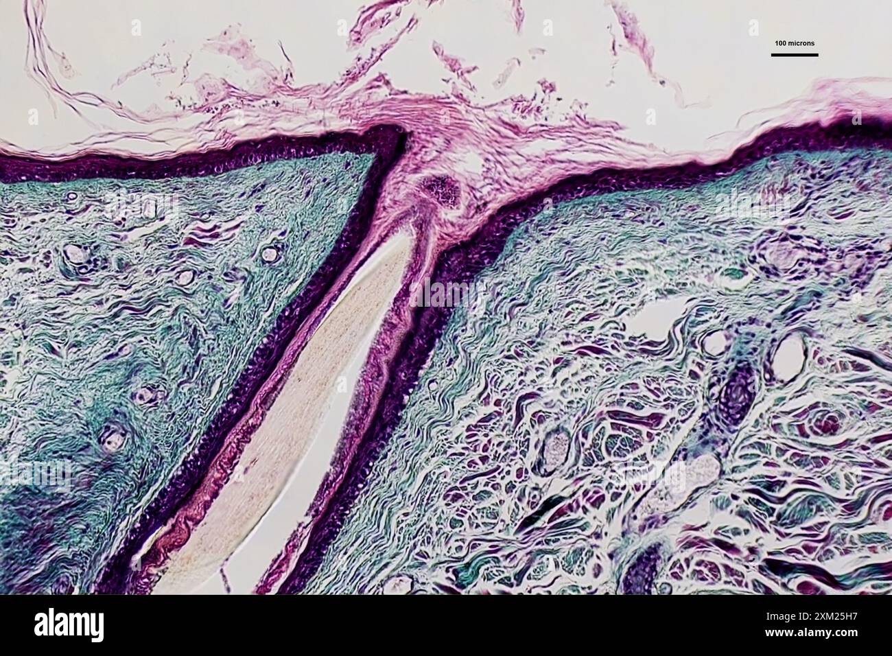 Micrografo della sezione verticale del cuoio capelluto umano che mostra l'inserimento dei capelli a un ingrandimento 10 volte superiore Foto Stock