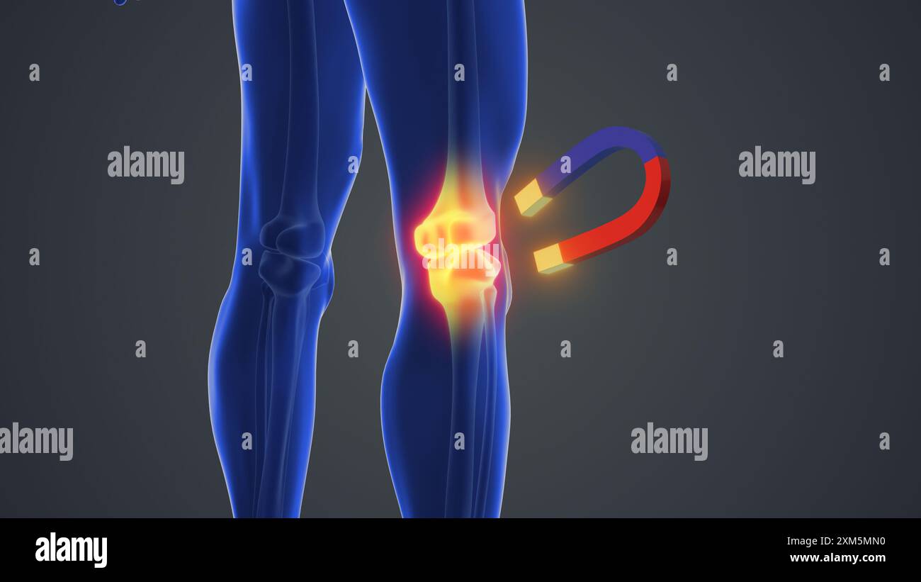 Terapia magnetica per dolori articolari del ginocchio Foto Stock