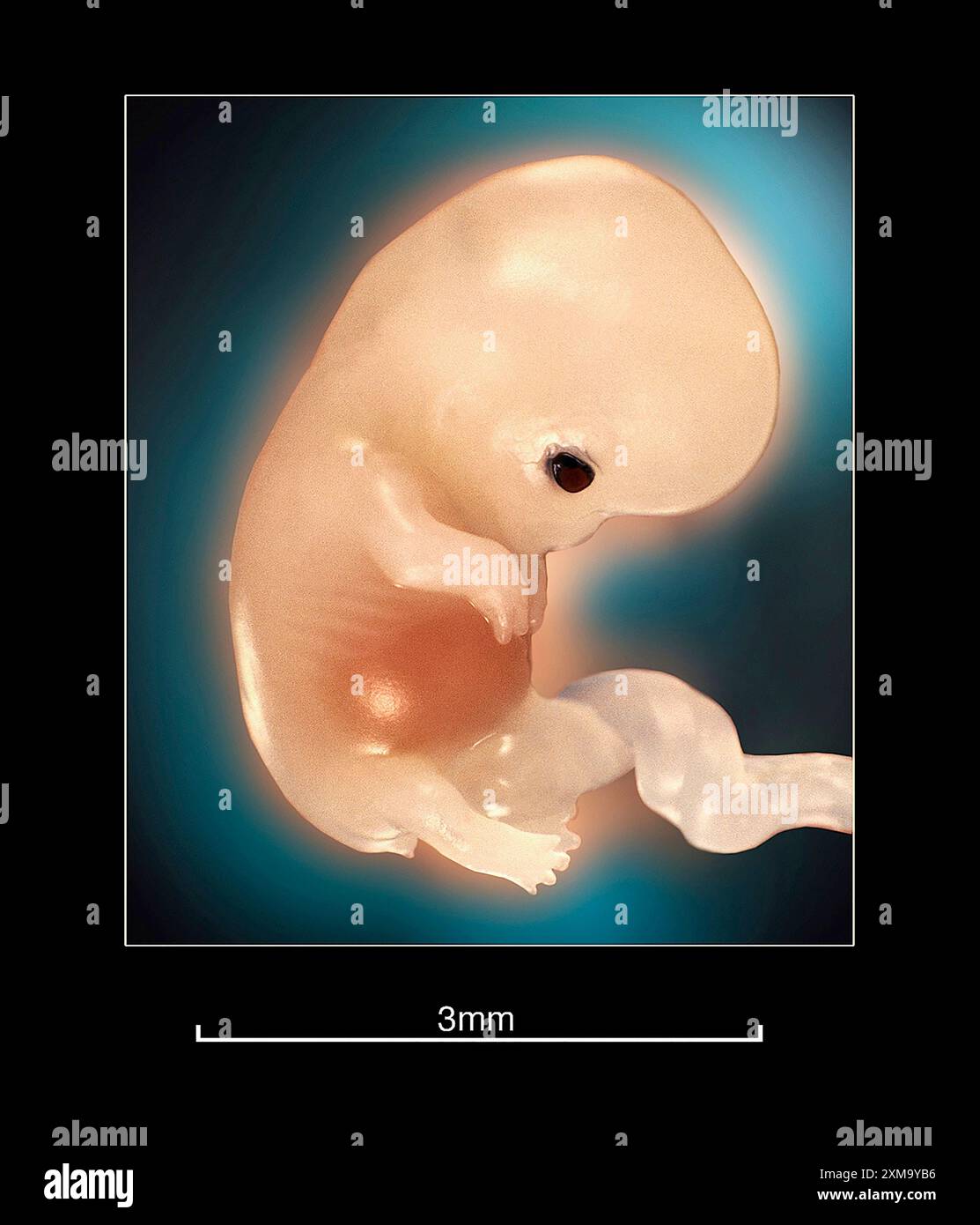 Feto umano nell'utero a circa 2-3 settimane dal concepimento. Immagine acquisita attraverso un ambito medico. Foto Stock