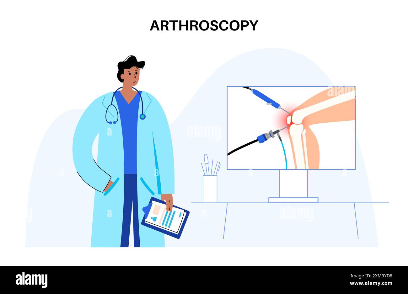 Illustrazione della procedura di artroscopia articolare del ginocchio. Si tratta di una procedura per la diagnosi e il trattamento dei problemi articolari. Un chirurgo inserisce un tubo stretto collegato a una videocamera a fibra ottica attraverso una piccola incisione. Foto Stock