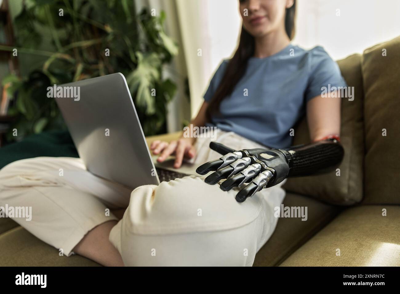 Giovane donna con protesi che usa un laptop seduto sul divano Foto Stock