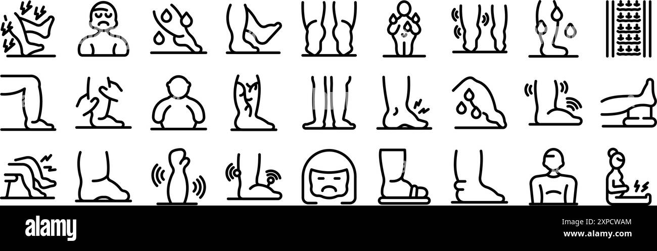 Set di icone edema. Persone che soffrono di dolore alle gambe e stanchezza mostrando sintomi di malattie come vene varicose, deformità del piede ed edema Illustrazione Vettoriale
