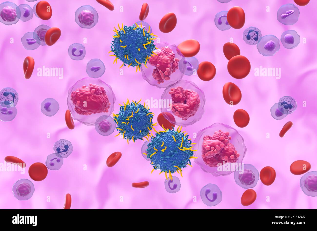 Terapia con cellule T di CAR nella leucemia linfocitica acuta (TUTTE) - Vista isometrica illustrazione 3d. Foto Stock