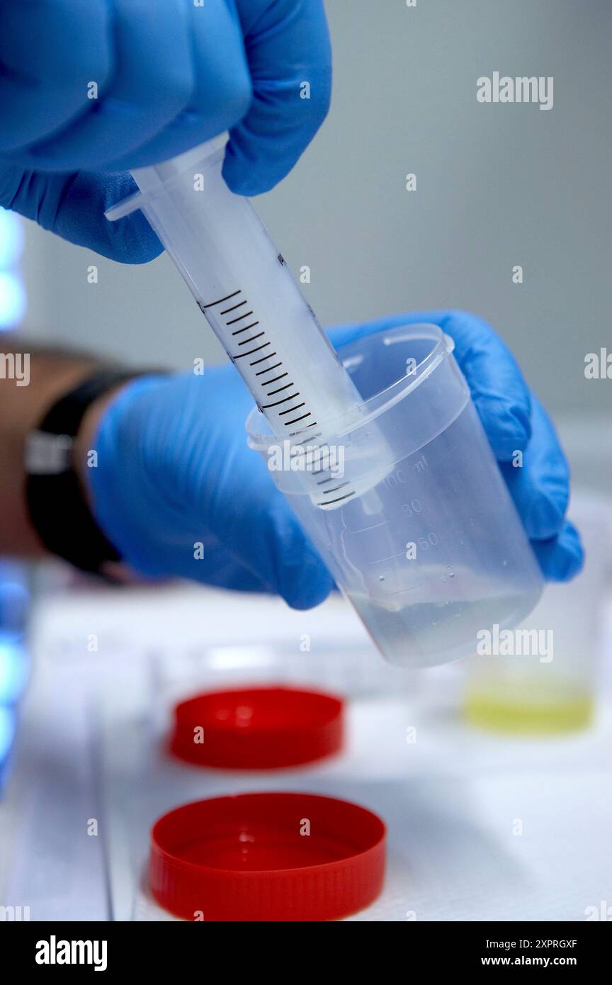 Anatomia patologica. Ospedale Universitario Gran Canaria medico Negrin, Las Palmas de Gran Canaria. Isole Canarie Spagna Foto Stock