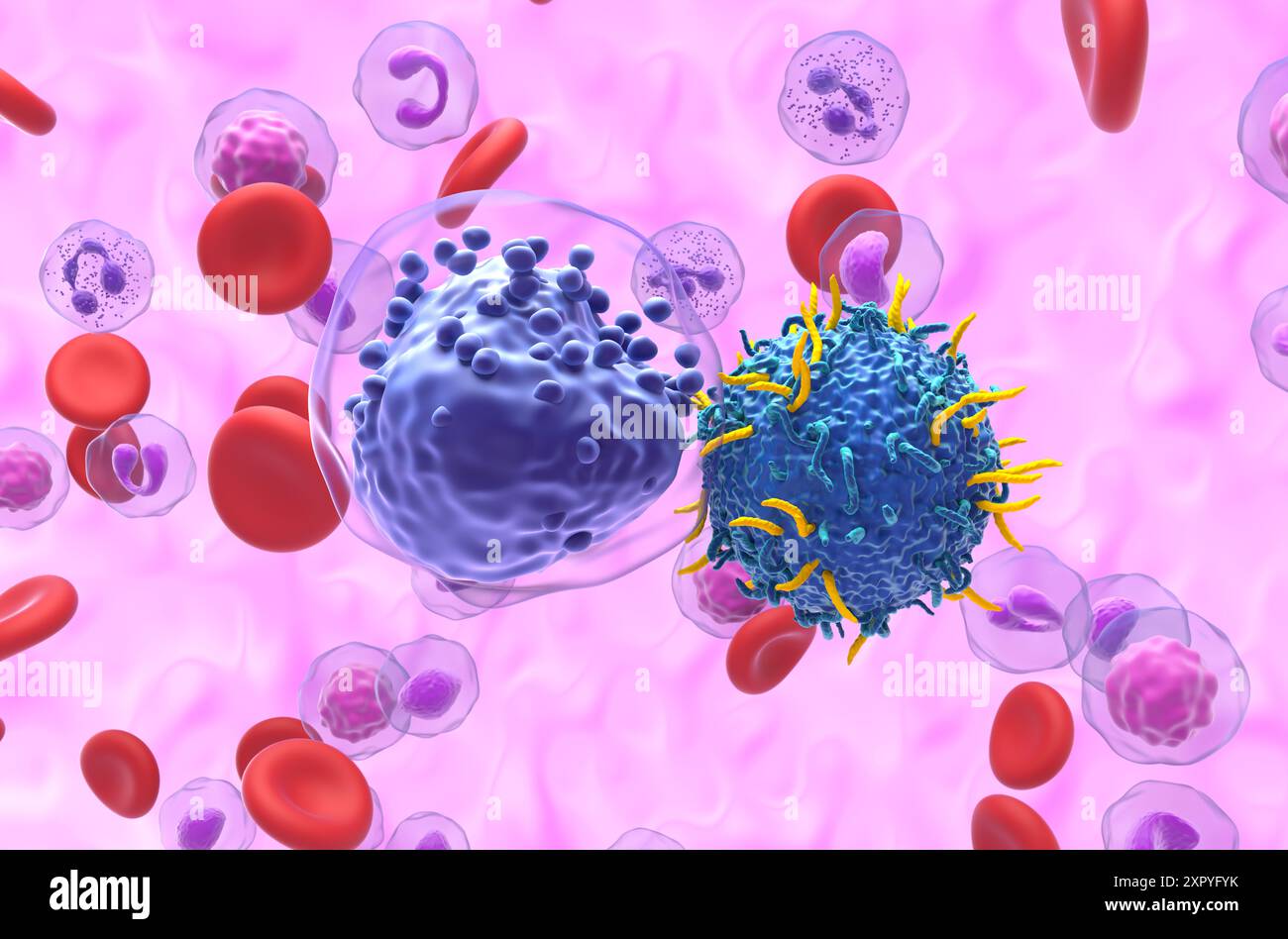 Terapia con cellule T di CAR nella leucemia mieloide acuta (LMA) - Vista ravvicinata illustrazione 3d. Foto Stock