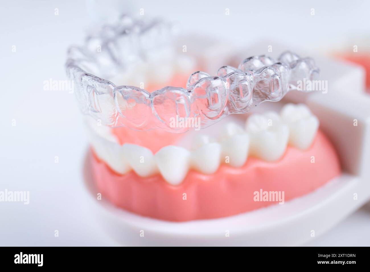 Cure dentistiche. Gli allineatori sono collocati su un modello artificiale di una mascella umana. Foto Stock