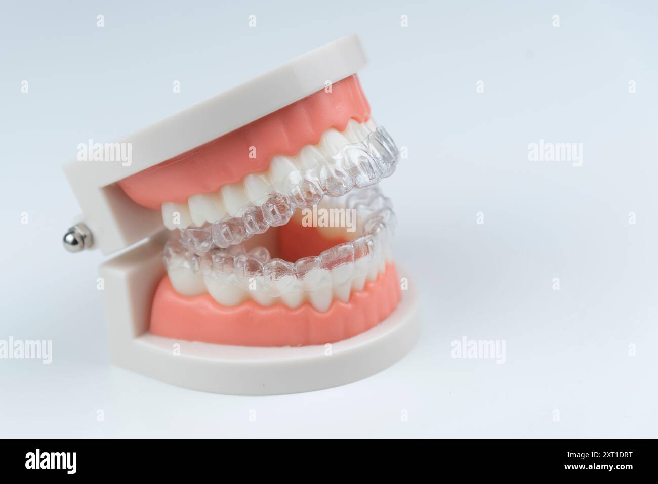 Cure dentistiche. Gli allineatori sono collocati su un modello artificiale di una mascella umana. Foto Stock