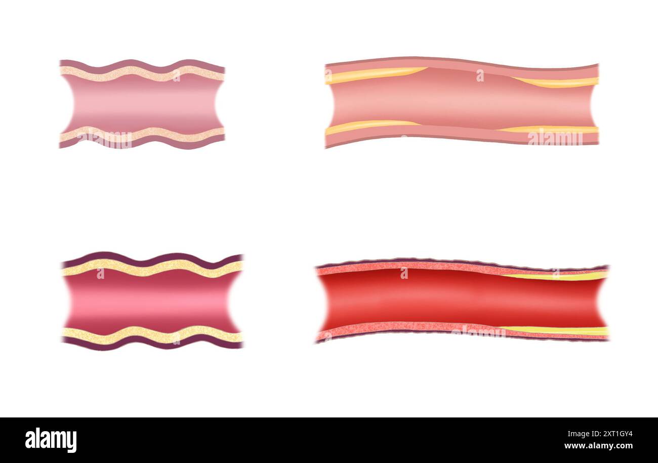 un grafico anatomico di un vaso sanguigno Foto Stock