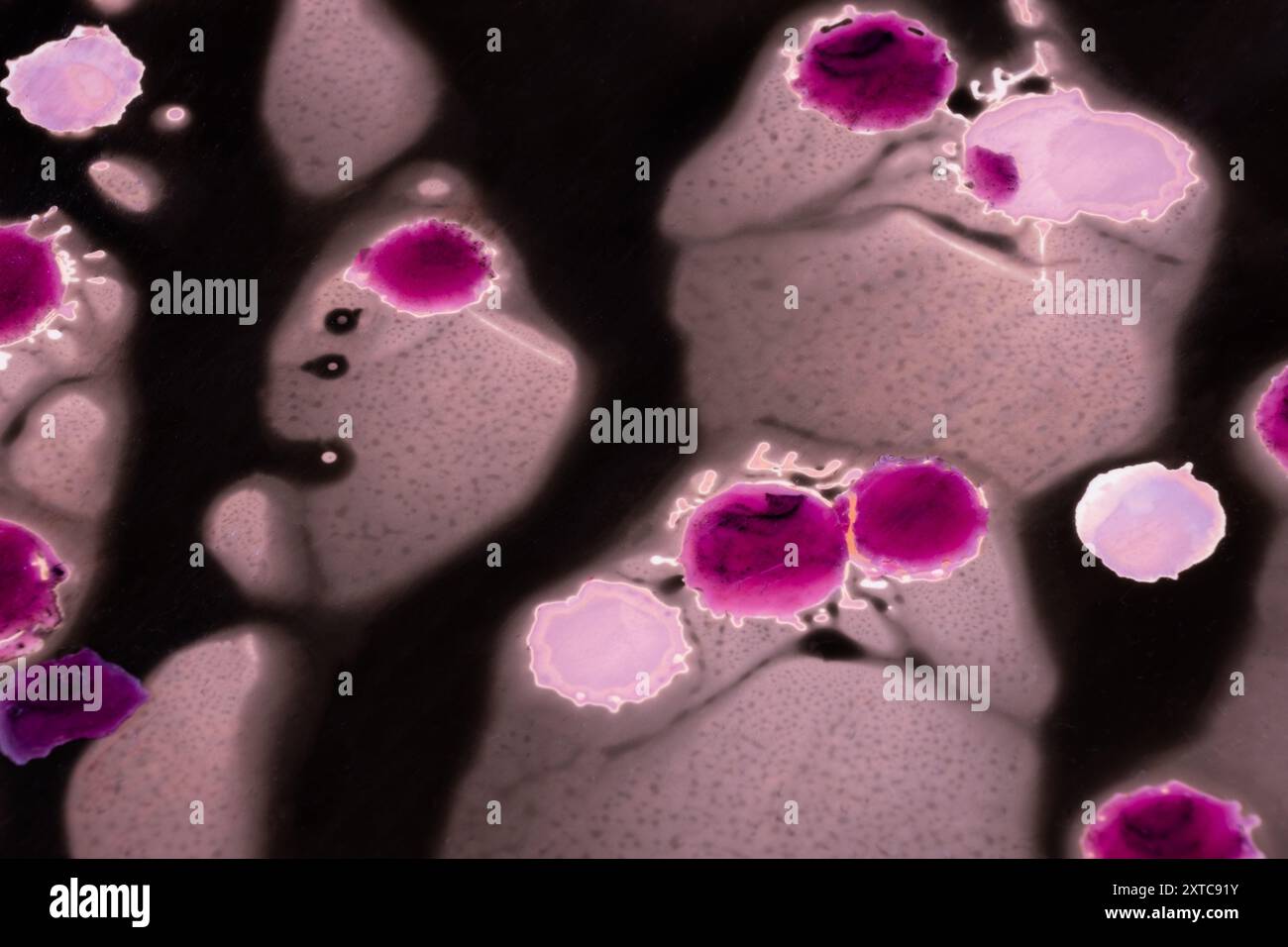 Opera visiva surreale realizzata utilizzando il processo chemigram e la cera viola, un lavoro astratto psicologico che esplora l'idea del colore infetto. Foto Stock