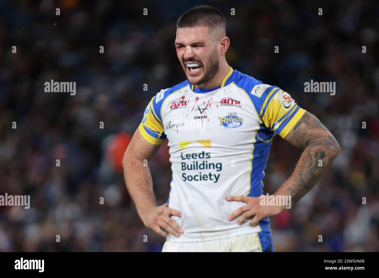 Leeds, Regno Unito. 17 agosto 2024. Elland Road, Leeds, West Yorkshire, 17 agosto 2024. Betfred Super League - Magic Weekend Warrington Wolves vs Leeds Rhinos James Bentley di Leeds Rhinos riceve un taglio alla vista crediti: Touchlinepics/Alamy Live News Foto Stock