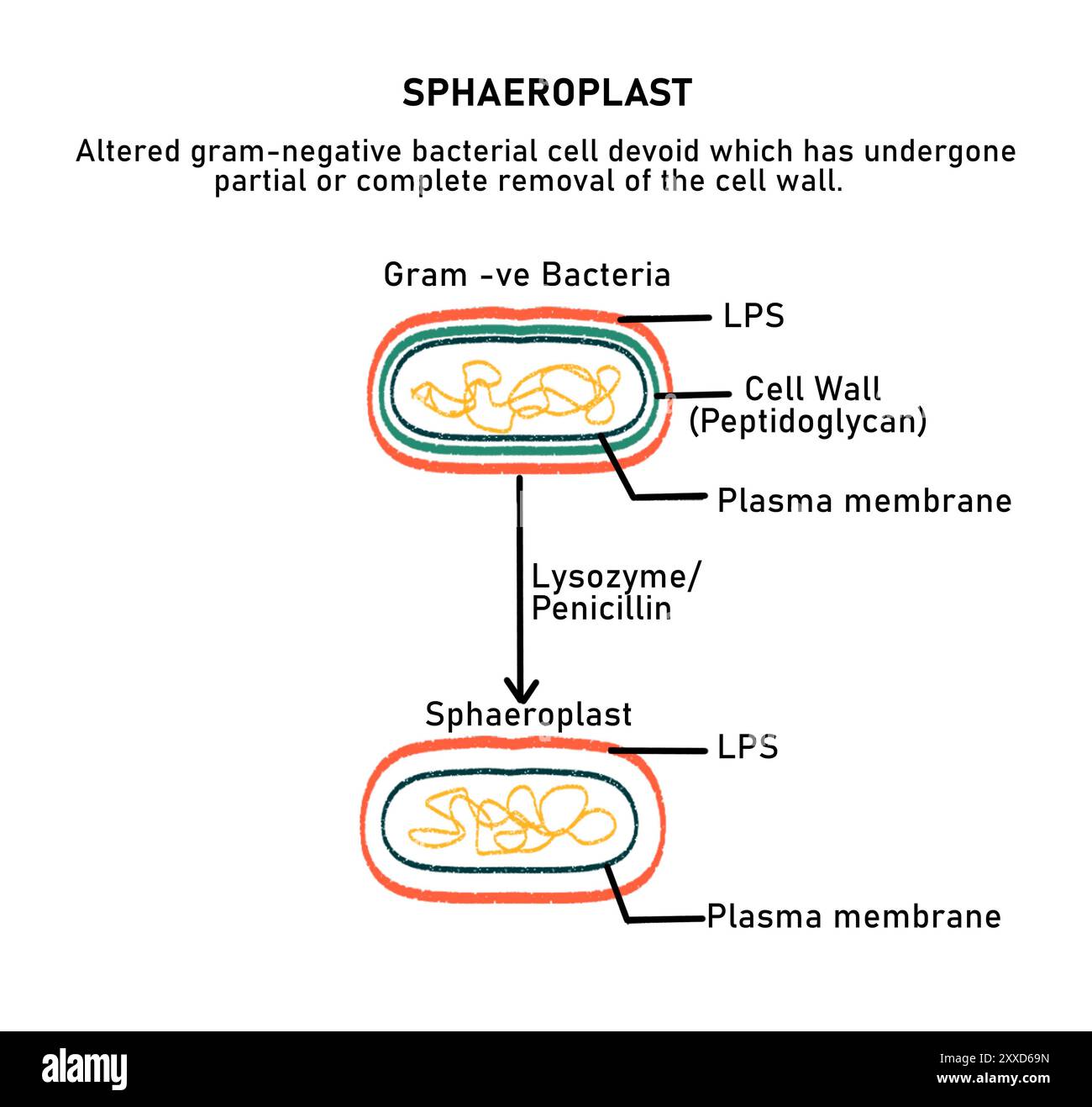 Sphaeroplast, illustrazione. Uno sfinoplast è un batterio Gram-negativo la cui parete cellulare è stata degradata da enzimi lasciando intatta la cellula con una membrana cellulare e uno strato di lipopolisaccaridi. Foto Stock