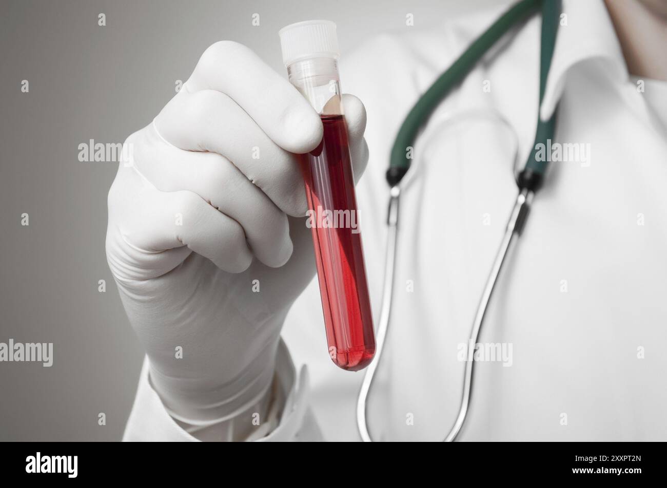 Medico tenendo una bottiglia di campione di sangue Foto Stock