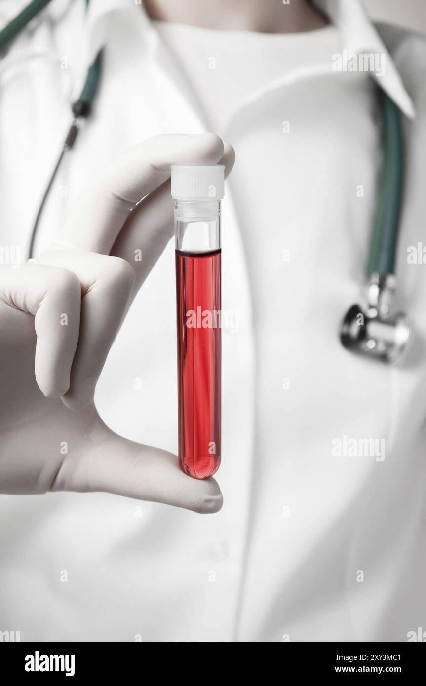 Medico tenendo una bottiglia di campione di sangue Foto Stock