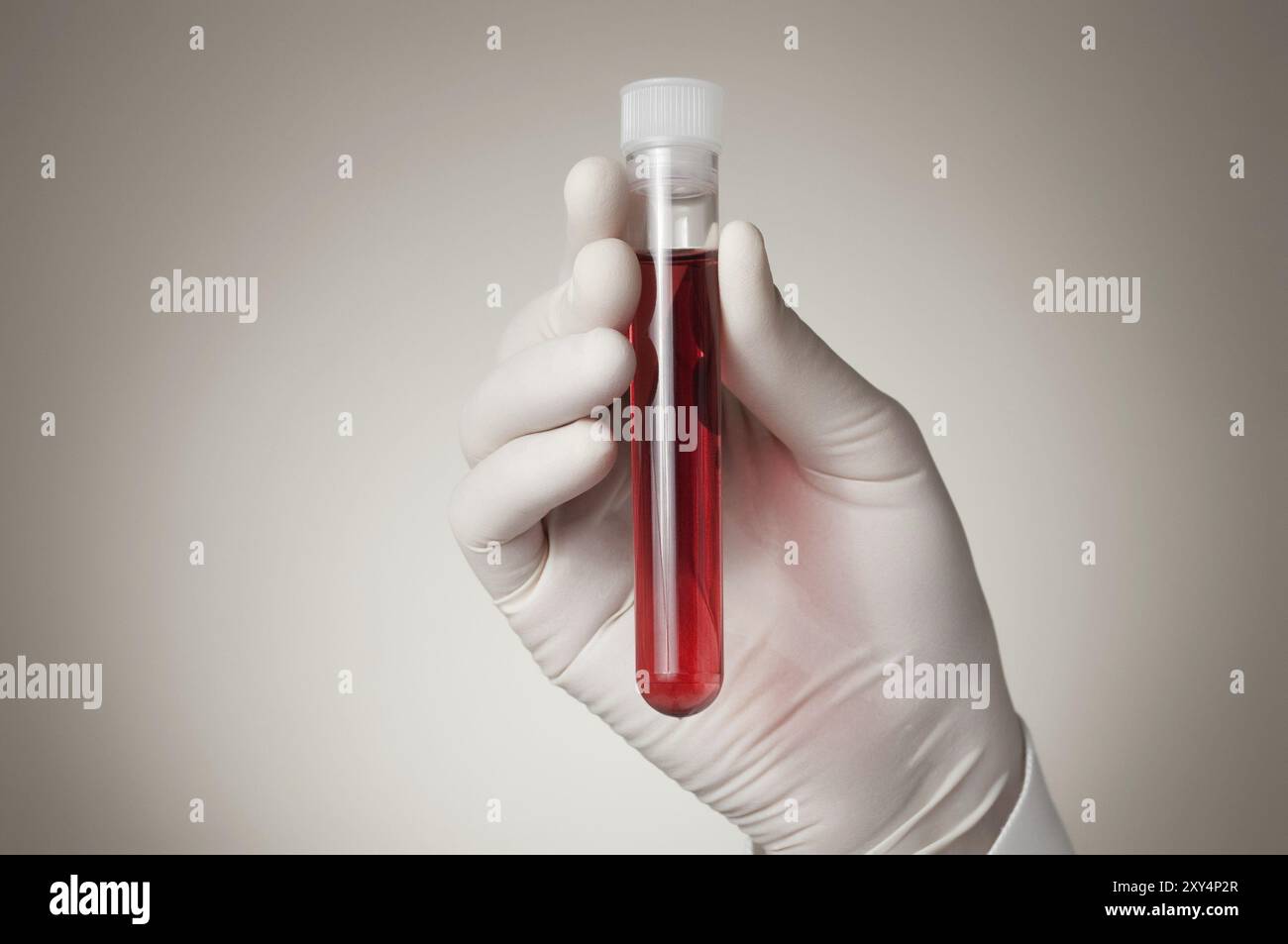 Medico tenendo una bottiglia di campione di sangue Foto Stock