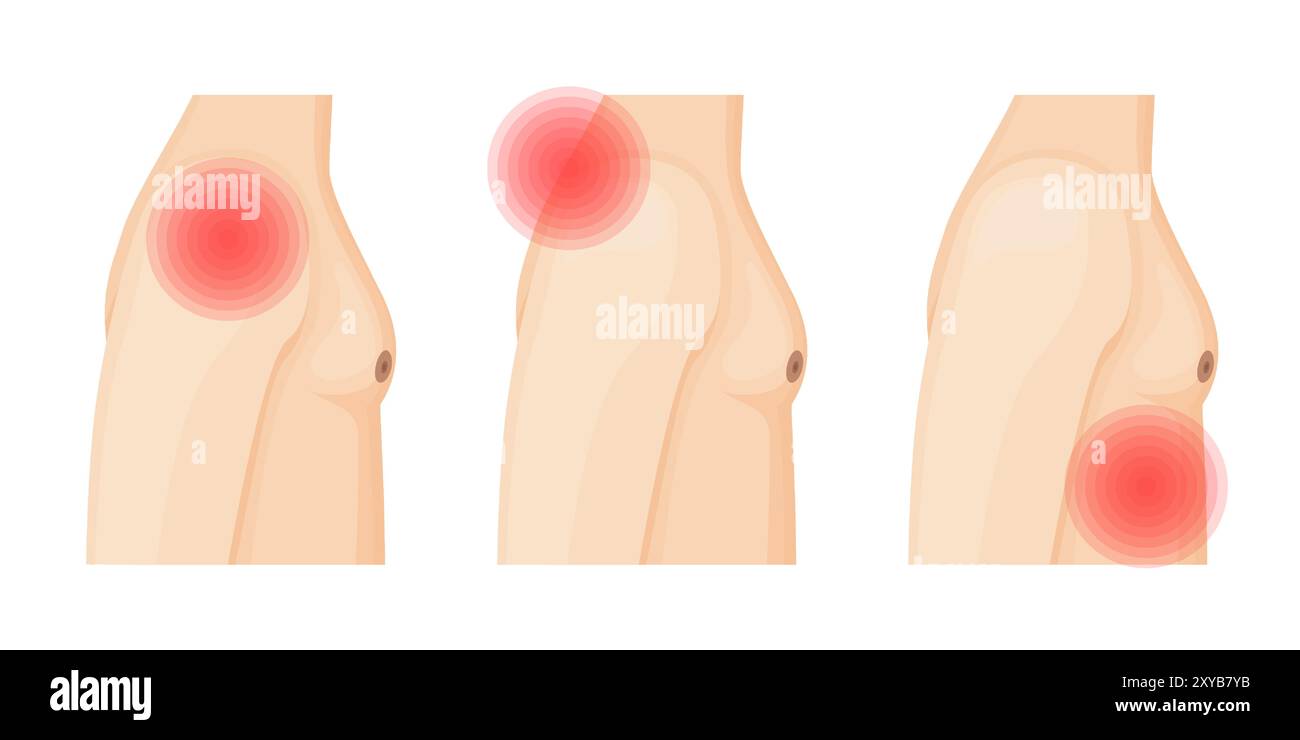 Uomo con dolore a spalla, collo e costole Illustrazione Vettoriale