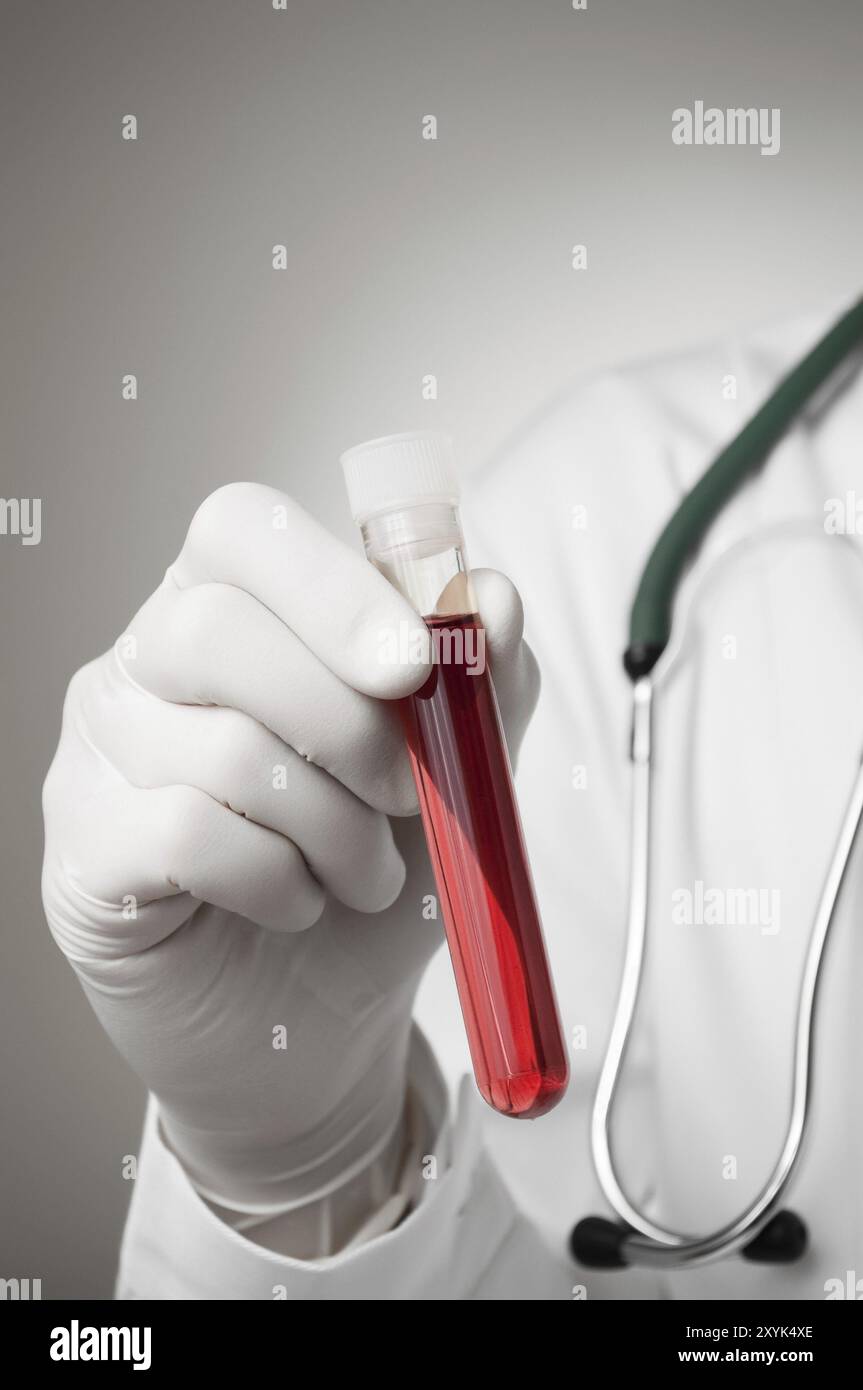 Medico tenendo una bottiglia di campione di sangue Foto Stock