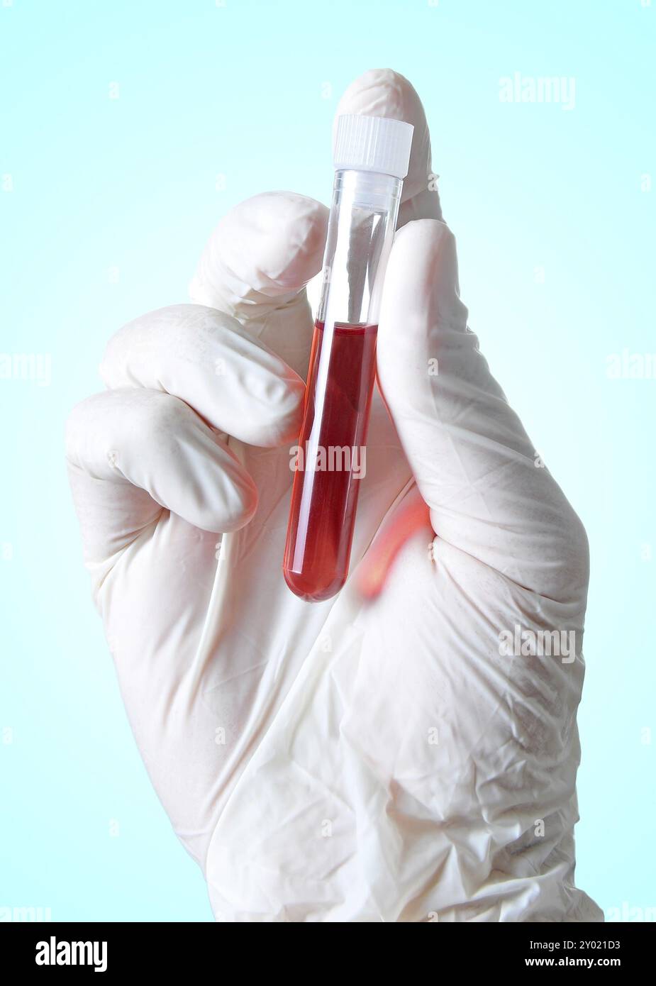 Mano che tiene un campione di sangue per analisi Foto Stock