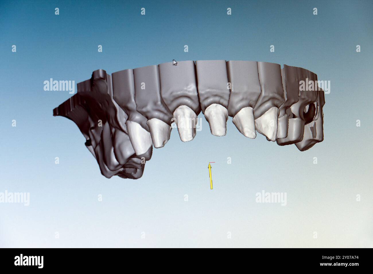 Visualizzazione del modello di ganascia superiore sullo schermo Foto Stock