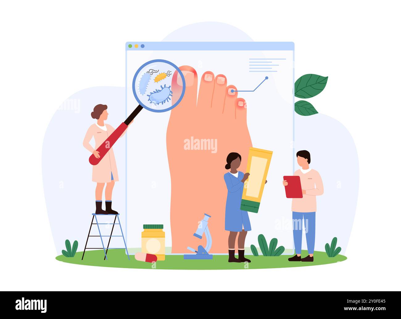 Diagnosi e trattamento di onicomicosi, dermatologia check-up in ospedale, podologia. Le piccole persone con lente d'ingrandimento rilevano l'infezione delle unghie del piede, l'infiammazione della pelle illustrazione del vettore del cartone animato Illustrazione Vettoriale