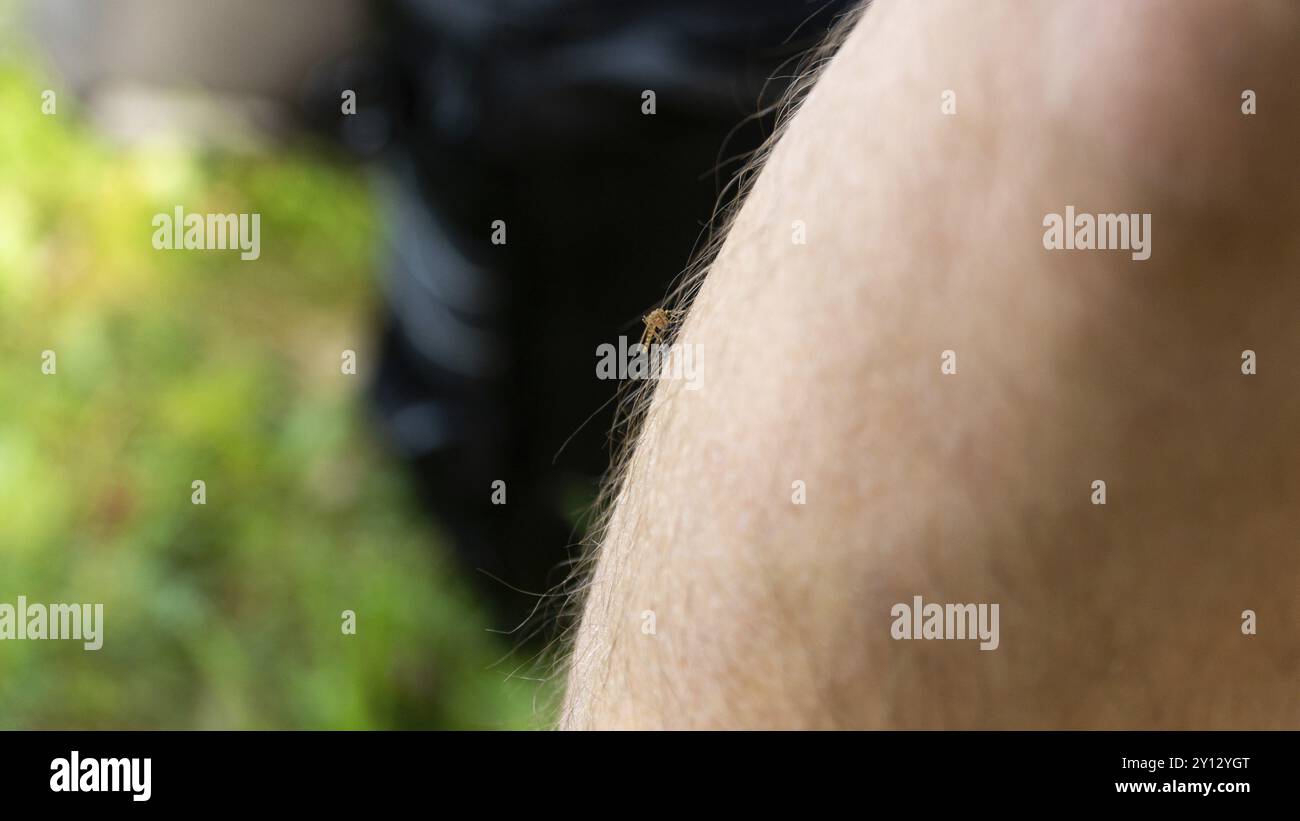 Foto di zanzara seduta sulla mano, perfora la pelle e succhia il sangue umano. Causa la malaria della malattia. Le zanzare sono pericolose portatrici di malattie Foto Stock