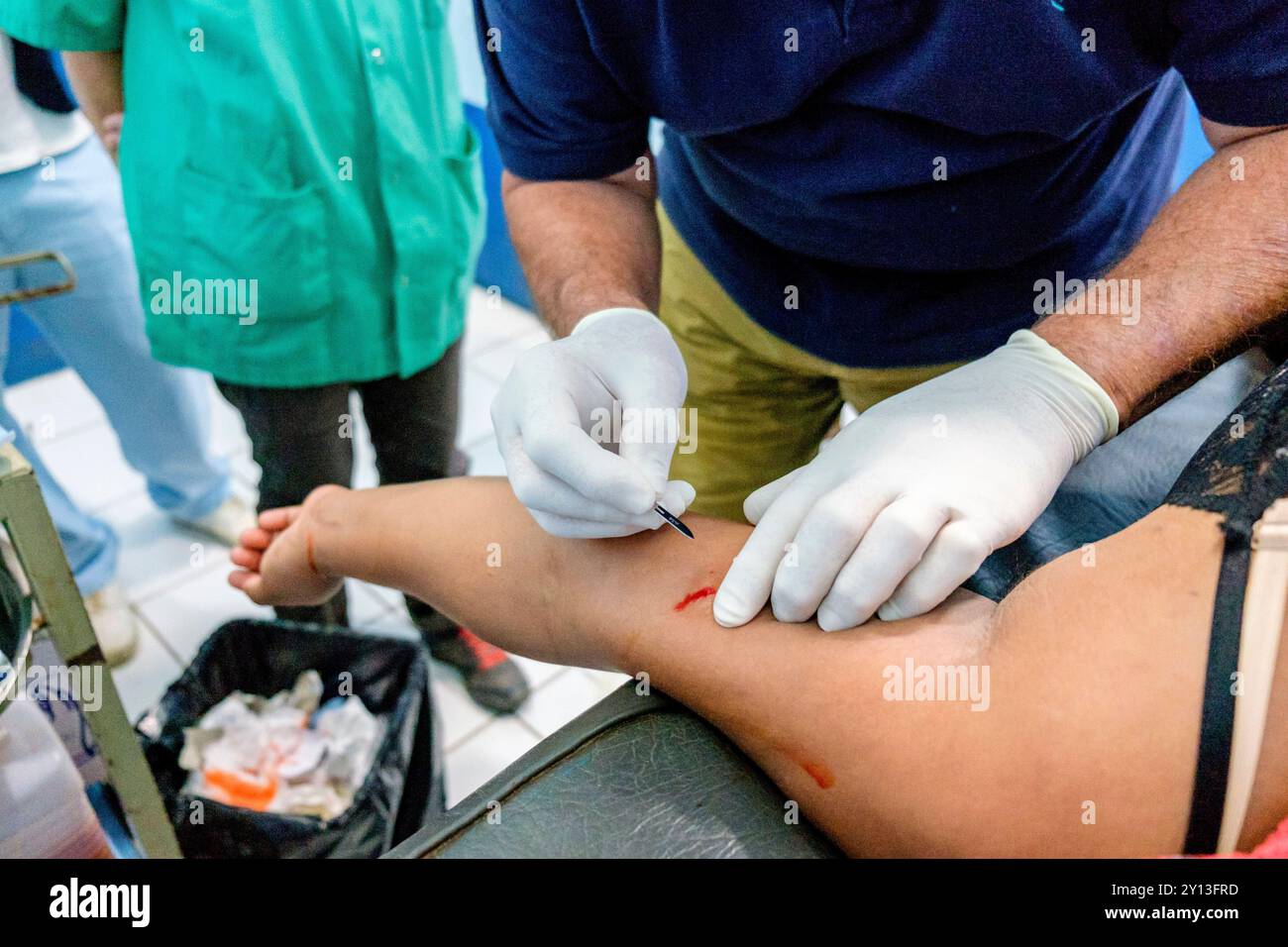 Rimozione dell'impianto contraccettivo ormonale, centro sanitario Lancetillo, la Parroquia, Quiche, Repubblica del Guatemala, America centrale. Foto Stock