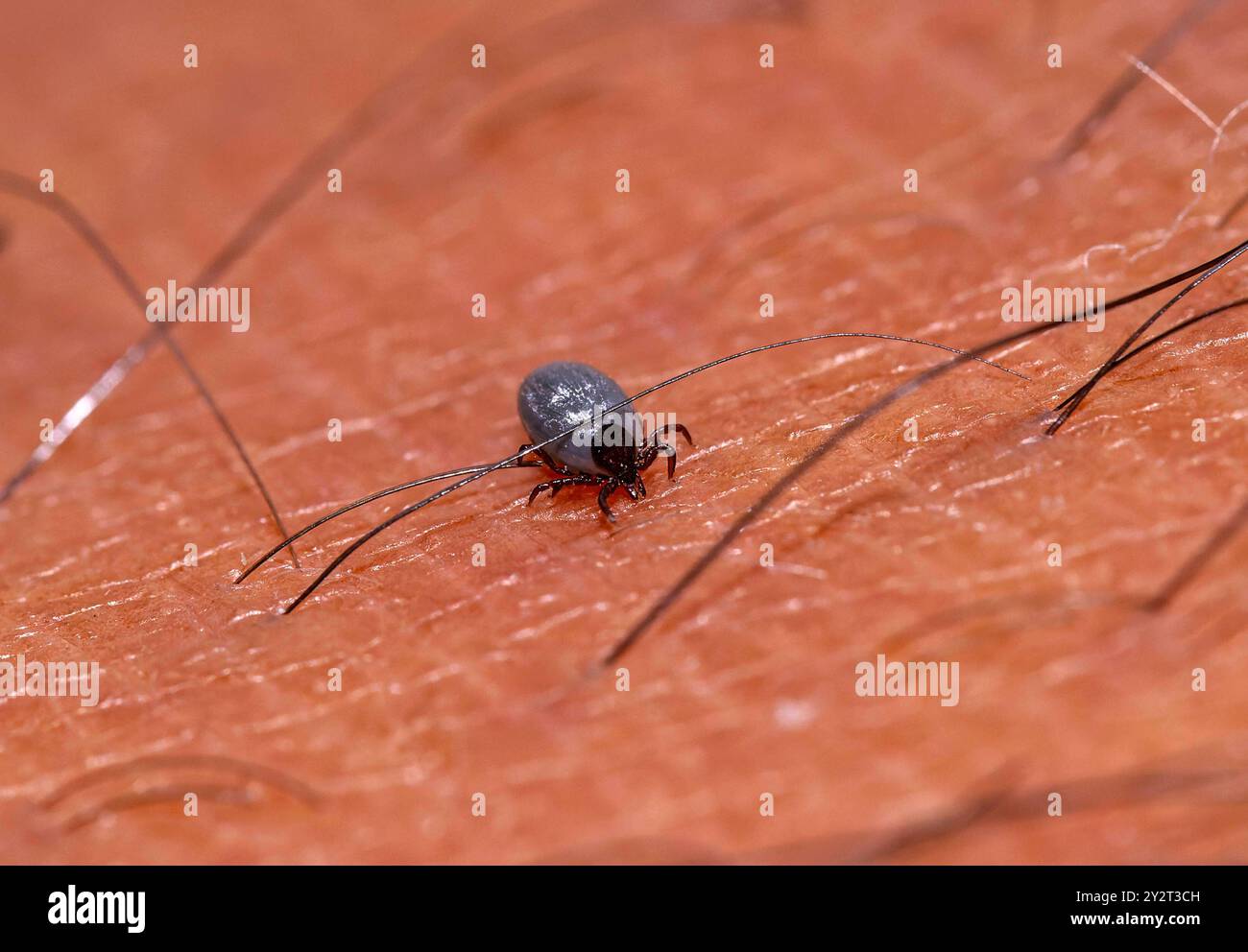 11.09.2024, Heimische Zecke sucht sich auf der menschlichen Haut eine stelle zum Blut saugen. Gemeiner Holzbock Ixodes ricinus 11.09.2024, Zecke 11.09.2024, Zecke **** 11 09 2024, Native tick search for a Place on Human skin to suck Blood zecca di legno comune Ixodes ricinus 11 09 2024, Tick 11 09 2024, Tick Foto Stock