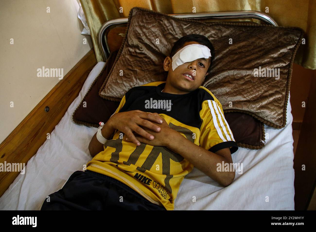 Beit Hanoun, Palestina. 2 giugno 2019. Al Baraa Fayeq Ahmed al-Kafarneh, 11 anni, riceve cure mediche in ospedale dopo che è stato ferito dai soldati israeliani il venerdì alle proteste al confine nella zona di Abu Safiya nel nord di Gaza. Il ragazzo ha perso l'occhio subito dopo essere stato colpito da un soldato israeliano con un proiettile di gomma e nonostante il trattamento ricevuto in un ospedale oftalmico a Gaza City. Secondo un rapporto pubblicato dall'organizzazione "Save the Children” alla fine di marzo scorso, almeno 49 bambini sono stati uccisi nella recinzione di frontiera di Gaza dall'inizio della grande marcia di ritorno Foto Stock