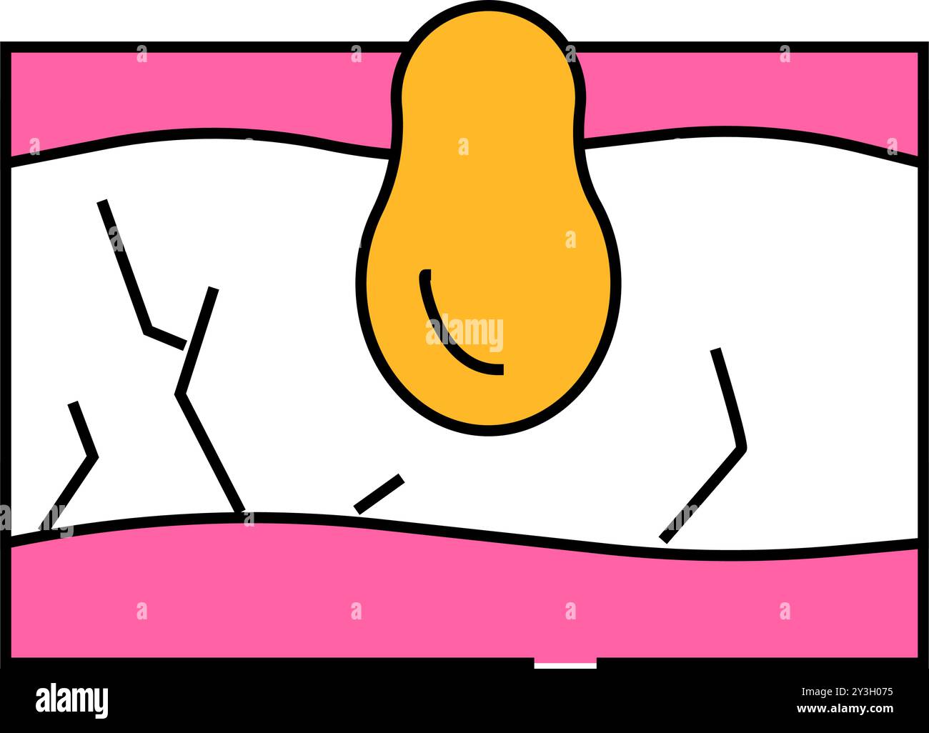 illustrazione del colore dell'icona del problema della pelle dell'acne Illustrazione Vettoriale