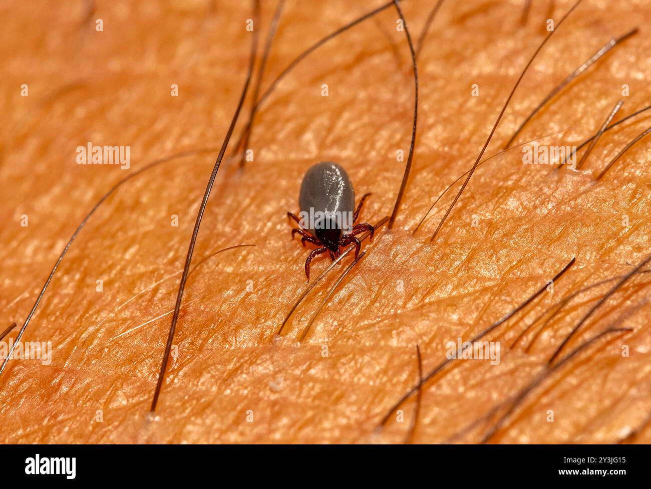 11.09.2024, Heimische Zecke sucht sich auf der menschlichen Haut eine stelle zum Blut saugen. Gemeiner Holzbock Ixodes ricinus 11.09.2024, Zecke 11.09.2024, Zecke **** 11 09 2024, Native tick search for a Place on Human skin to suck Blood zecca di legno comune Ixodes ricinus 11 09 2024, Tick 11 09 2024, Tick Foto Stock