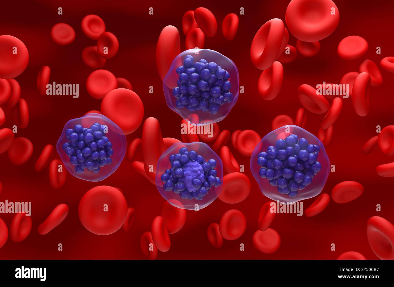 Linfoma diffuso a grandi cellule B (DLBCL) - Vista isometrica illustrazione 3d. Foto Stock