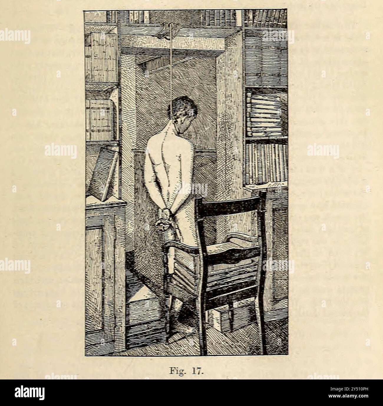 A impiccato man from Forensic medicine and Toxicology di Mann, J. Dixon (John Dixon), 1840-1912 data di pubblicazione 1898 pubblicato da Charles Griffin Foto Stock