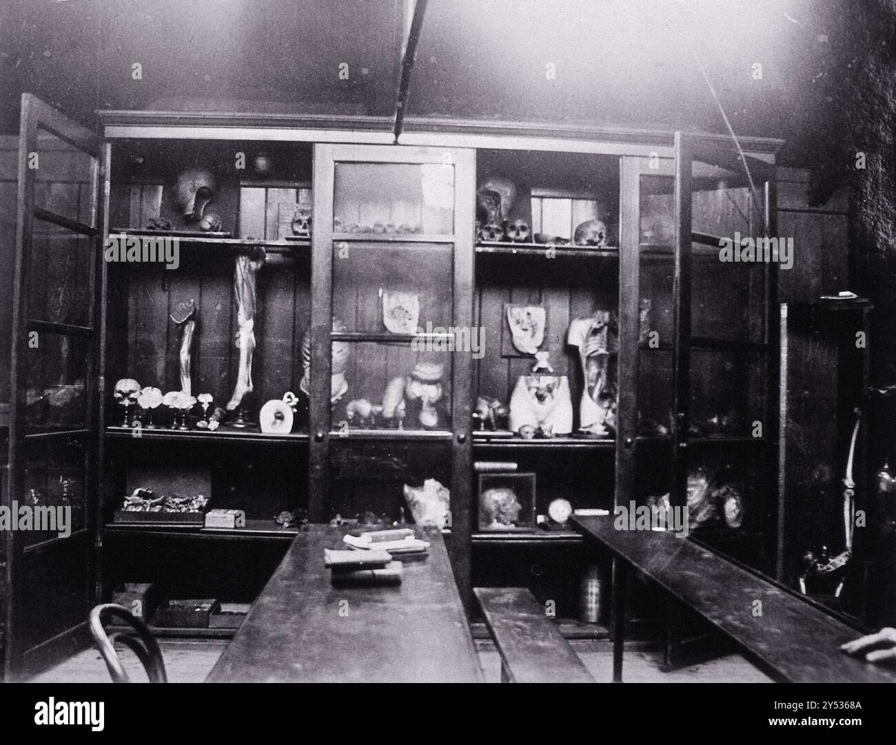 Cooke's School of Anatomy (London School of Anatomy), Londra: Interni, che mostrano campioni anatomici in una credenza. Fotografia, circa 1920 anni Foto Stock