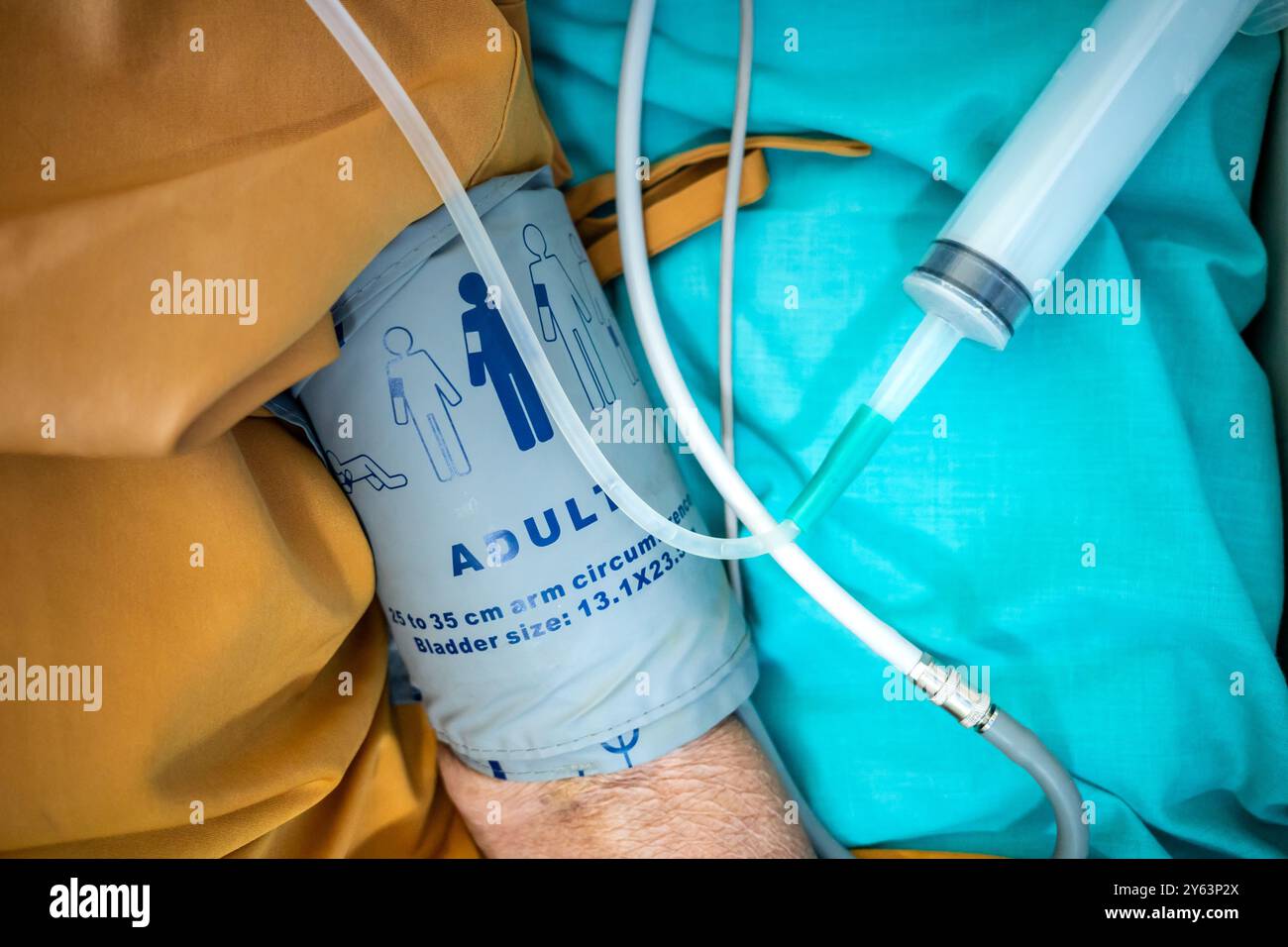 Braccio di un paziente ricoverato in ospedale che utilizza sfigmomanometro per misurare la pressione sanguigna Foto Stock