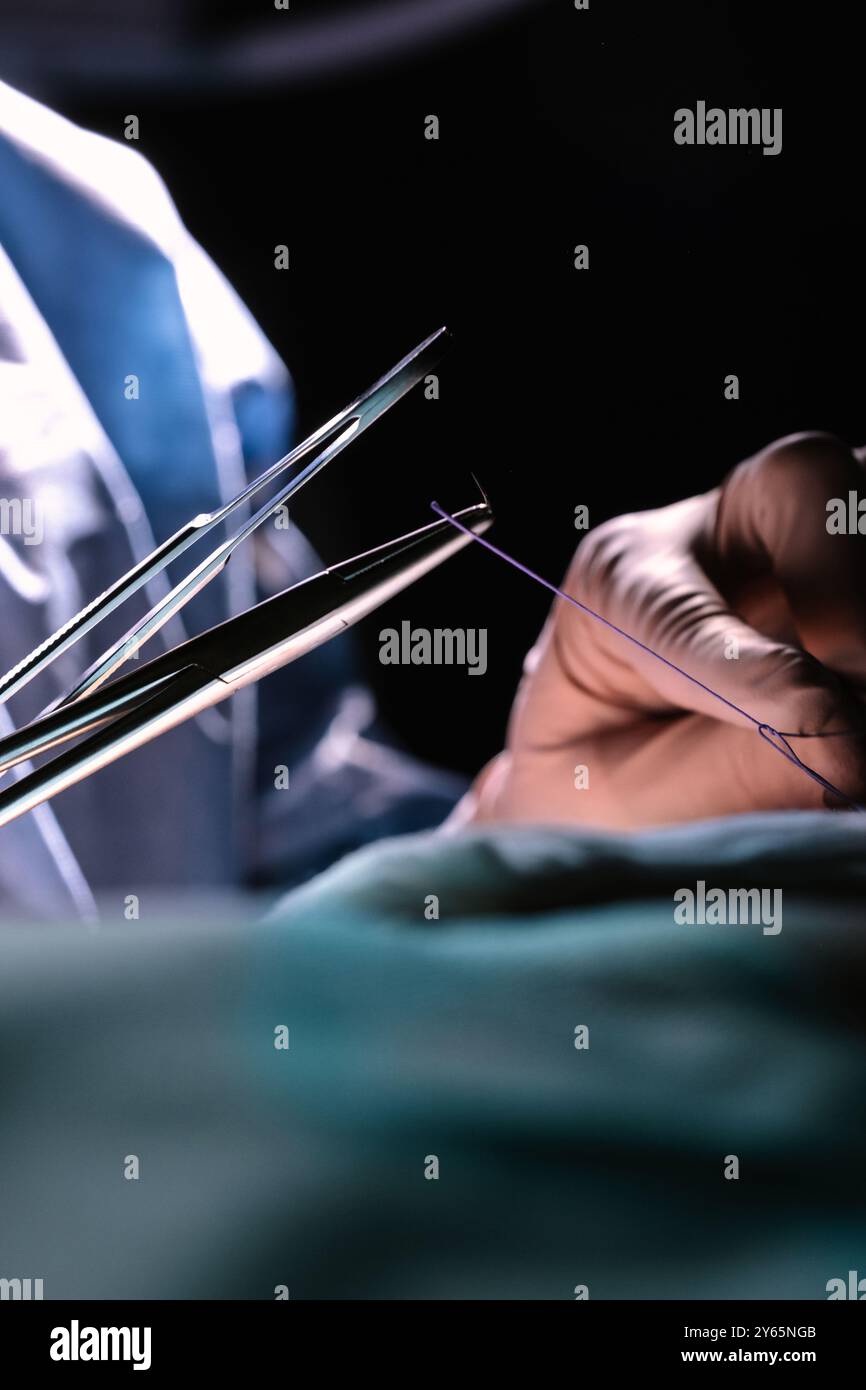 Immagini in primo piano che catturano la precisione e la messa a fuoco di un intervento chirurgico evidenziate sono gli strumenti chirurgici e le suture utilizzati da un guanto S Foto Stock