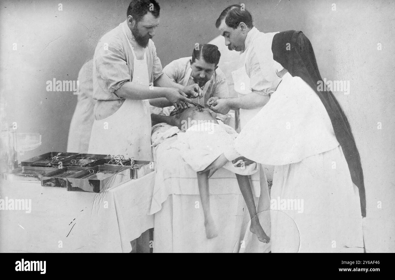 Legando le arterie dei gemelli Hindoo dopo l'operazione, la foto mostra il Dr. Eugene-Louis Doyen che esegue un intervento chirurgico per separare i gemelli radica e Doodica nel 1902., 1902, Glass negatives, 1 negativo: Vetro; 5 x 7 pollici. o più piccolo. Foto Stock