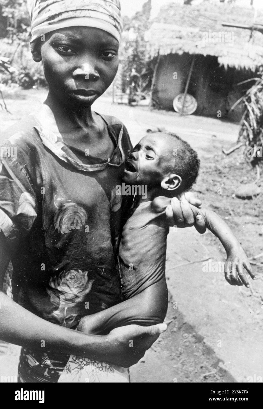 La madre nigeriana tiene in mano al bambino un fascio di pelle e ossa dopo che i due sono stati portati in un centro di assistenza alla carestia dell'UNICEF (Fondo delle Nazioni Unite per l'infanzia). 21 agosto 1968 Foto Stock