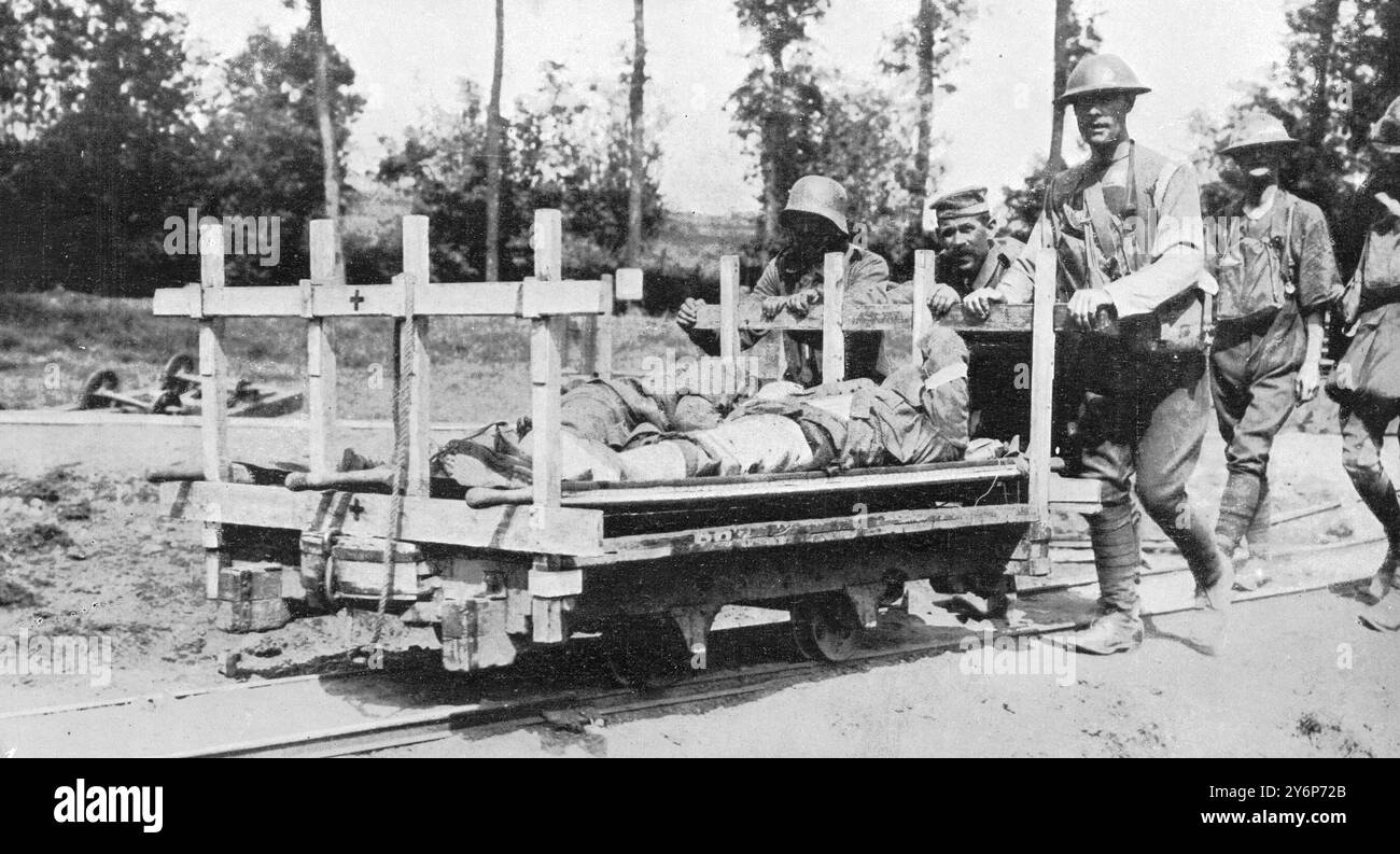 La battaglia di Messines Ridge: Due fasi della lotta: Parte dell'inevitabile pedaggio della vittoria: Portare i feriti due prigionieri tedeschi che aiutano con i casi di barella su un tram ferroviario. 16 giugno 1917 Foto Stock
