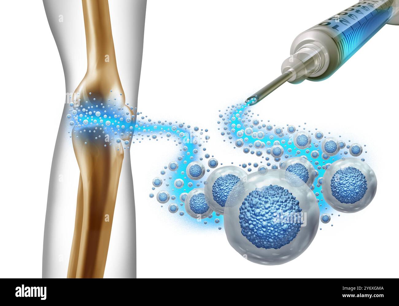 Salute rigenerativa Medicina e cellule staminali di Mesenchymal iniettate per dolore articolare del ginocchio per rigenerare la riparazione del tessuto come un'illustrazione medica di terapia cellulare Foto Stock