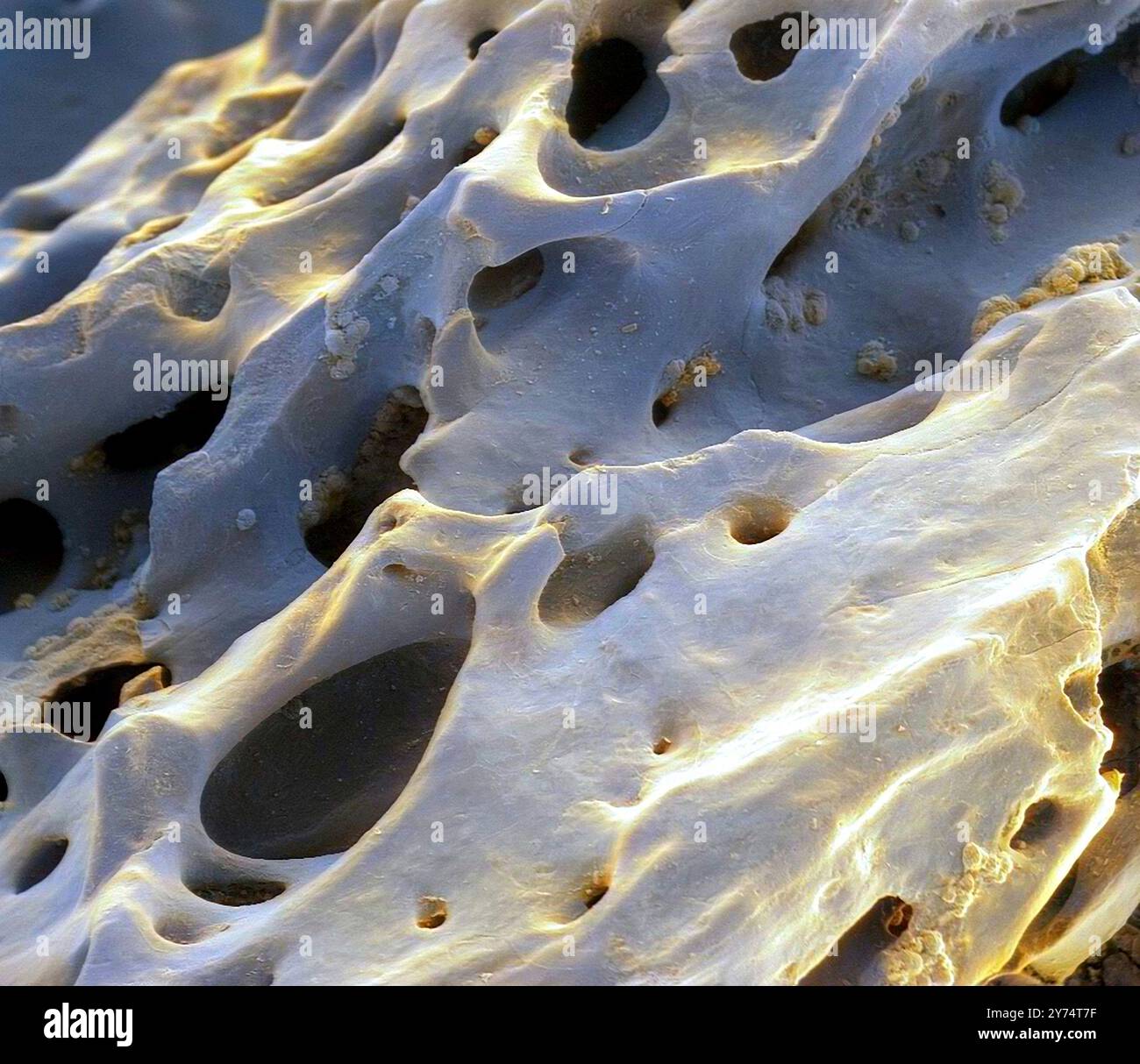 Osso di dinosauro fossilizzato, micrografo elettronico a scansione colorata (SEM). Questo esemplare proviene da un fossile di Tyrannosaurus rex. Questo dinosauro era un carnivoro del periodo Cretaceo. I fori circolari sono i canali haversiani che trasportano vasi sanguigni. Ingrandimento: X20 se stampato a 10 centimetri di larghezza. Foto Stock