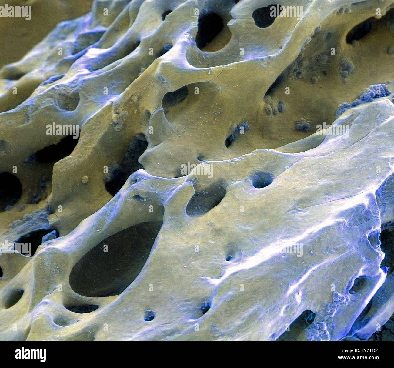 Osso di dinosauro fossilizzato, micrografo elettronico a scansione colorata (SEM). Questo esemplare proviene da un fossile di Tyrannosaurus rex. Questo dinosauro era un carnivoro del periodo Cretaceo. I fori circolari sono i canali haversiani che trasportano vasi sanguigni. Ingrandimento: X20 se stampato a 10 centimetri di larghezza. Foto Stock