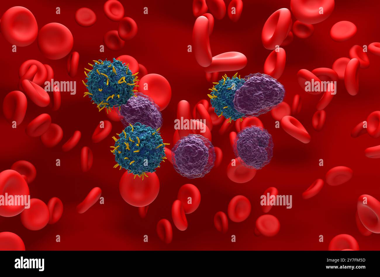Terapia con cellule T di CAR nel linfoma non hodgkin (NHL) - Vista isometrica illustrazione 3d. Foto Stock