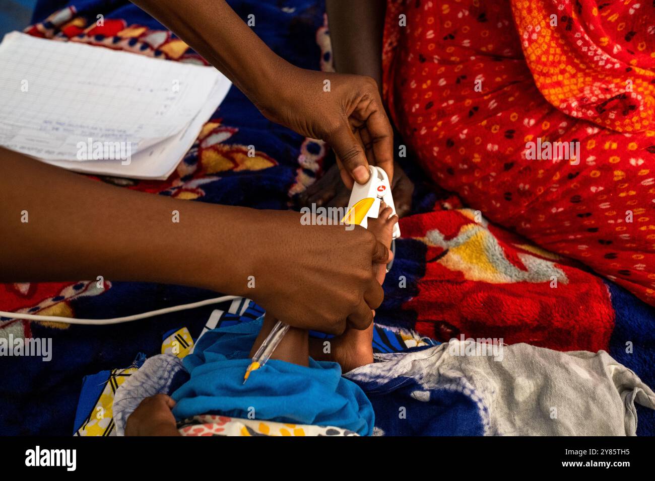 Controllare lo stato di salute di un bambino malnutrito presso l'ospedale pediatrico dell'organizzazione non gouvernmental ONG Medecins Sans Frontieres Foto Stock