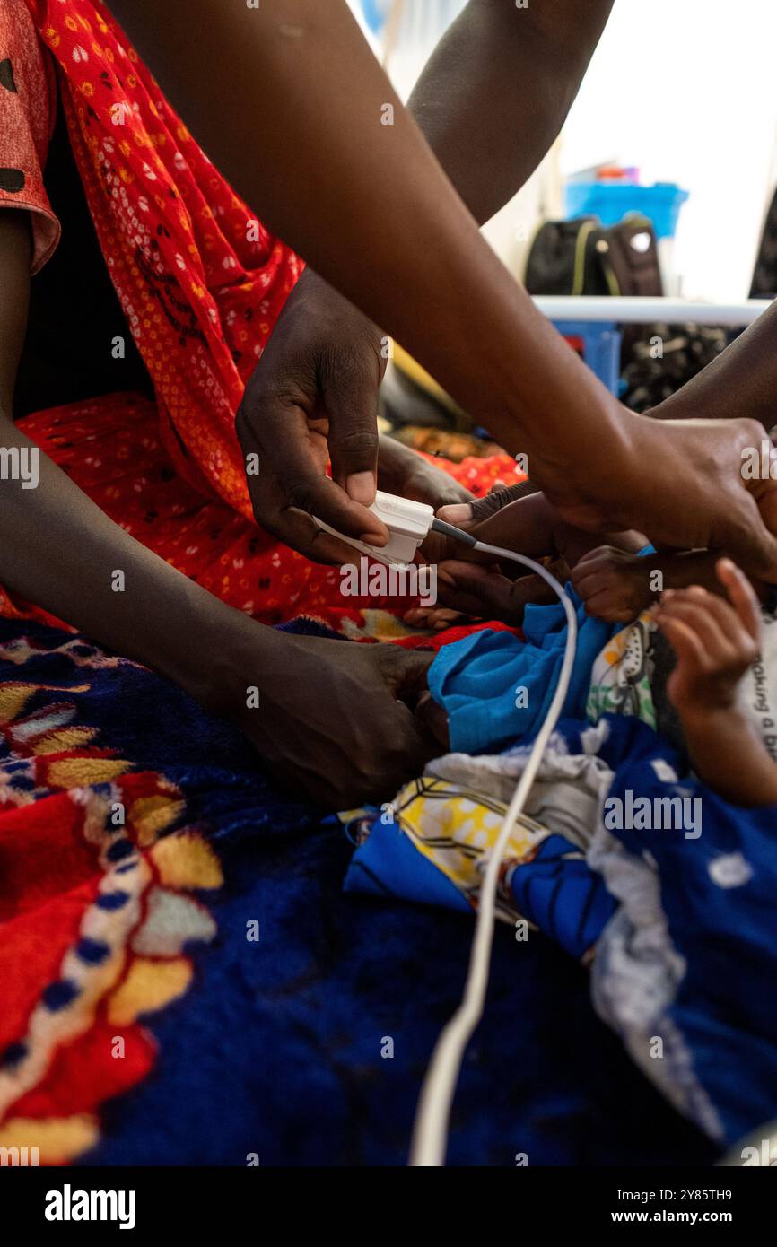 Controllare lo stato di salute di un bambino malnutrito presso l'ospedale pediatrico dell'organizzazione non gouvernmental ONG Medecins Sans Frontieres Foto Stock