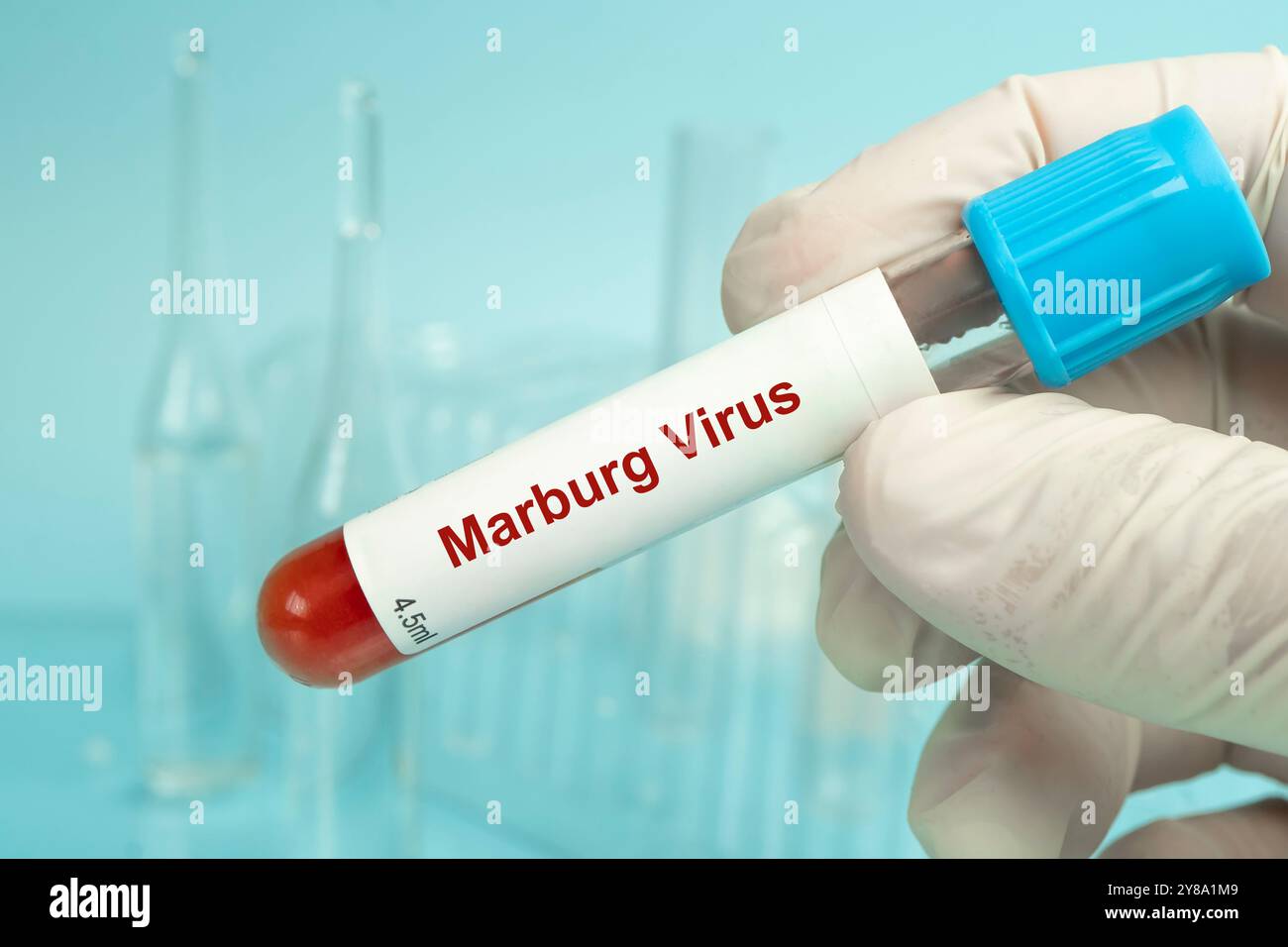 Marburgvirus, campione di sangue per il test della malattia da virus di Marburg. Il virus di Marburg è un virus della febbre emorragica della famiglia Filoviridae Foto Stock