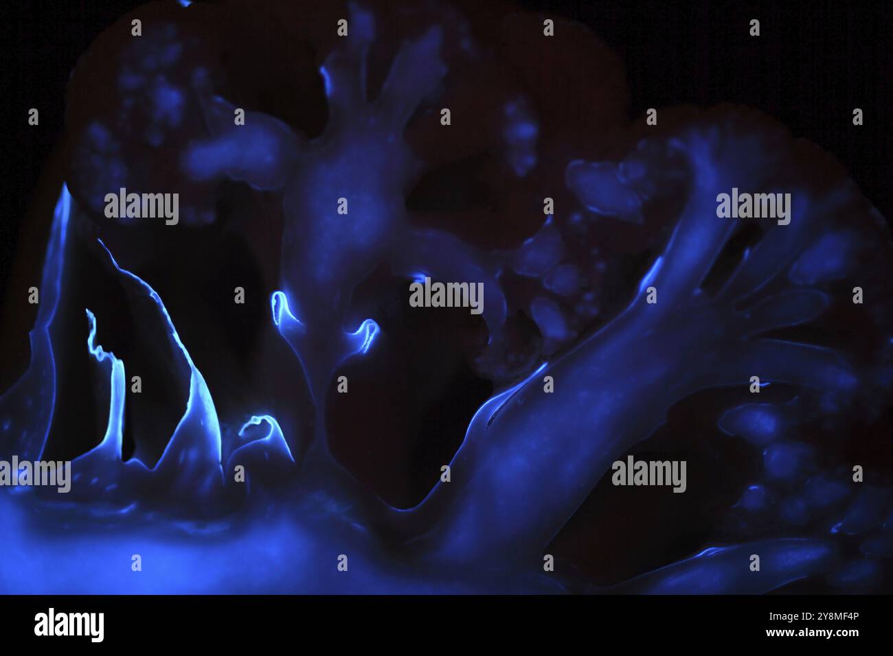 Il luminolo è una sostanza chimica utilizzata in medicina forense per rilevare tracce di sangue. Il luminolo reagisce con varie sostanze chimiche ossidanti per produrre chemiluminescenza. Questi Foto Stock