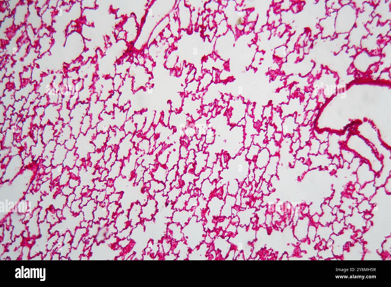 Una sezione attraverso polmoni cellule e aveoli sotto il microscopio Foto Stock